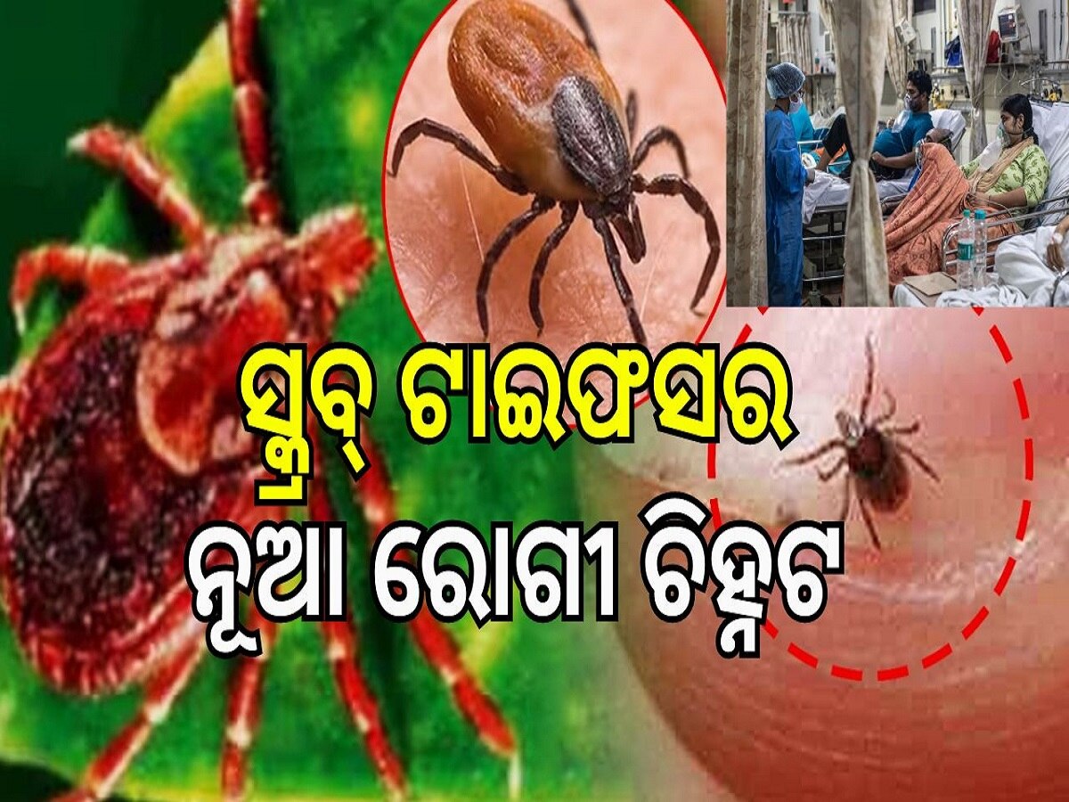 Scrub Typhus: ହୋଇଯାଆନ୍ତୁ ସତର୍କ! ରାଜ୍ୟରେ ୨୨୦ ଟପିଲା ସ୍କ୍ରବ୍ ଟାଇଫସ ଆକ୍ରାନ୍ତଙ୍କ ସଂଖ୍ୟା..