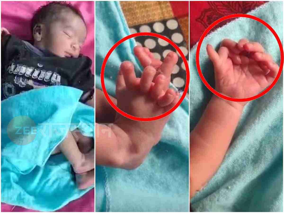 राजस्थान के डीग में जन्मी 26 उंगलियों वाली दुर्लभ बच्ची, घरवाले बता रहे देवी का रूप