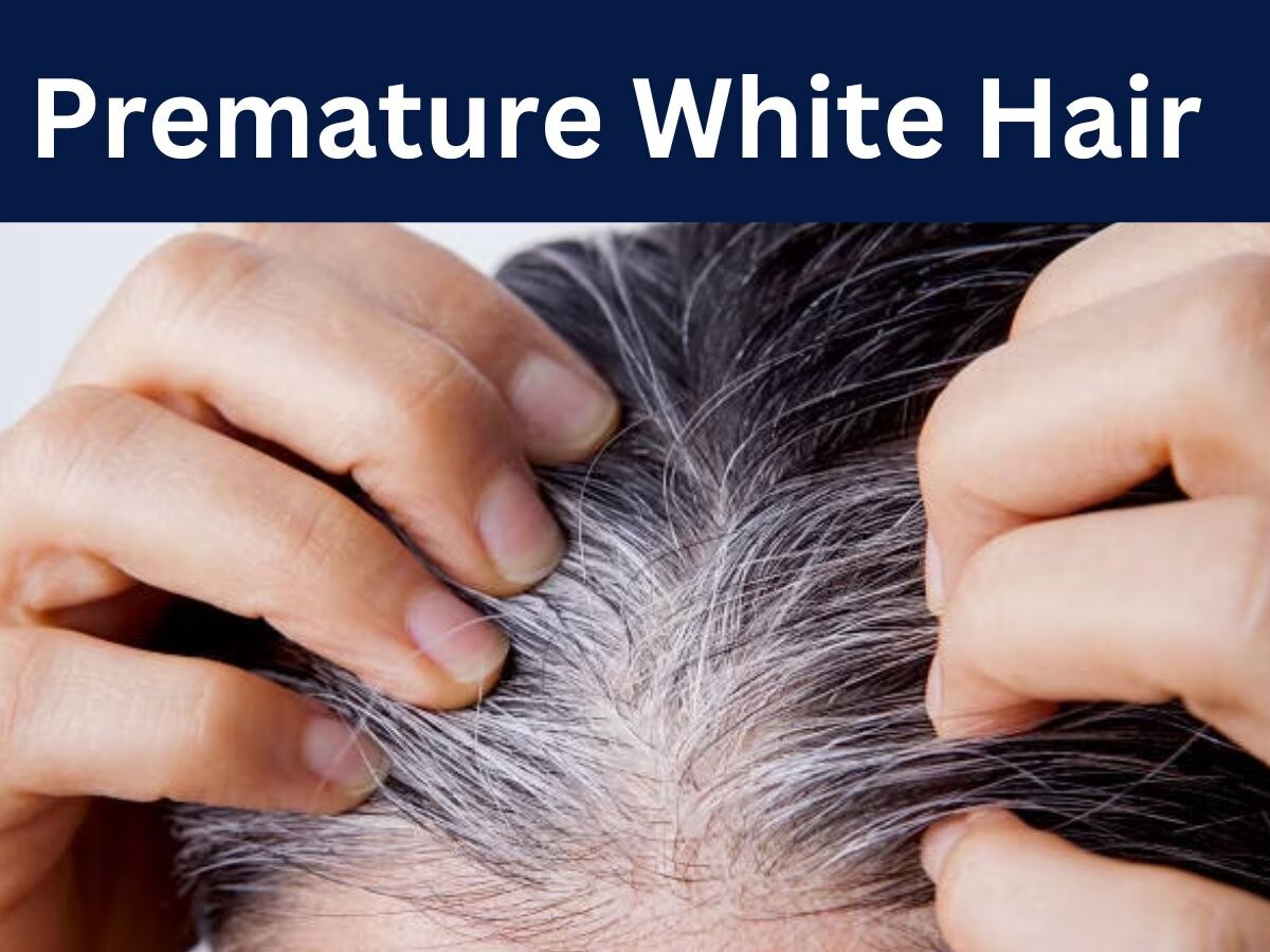 White Hair: कम उम्र में सफेद बाल आने से रोक सकते हैं आप, बस करने होंगे ये 5 काम 