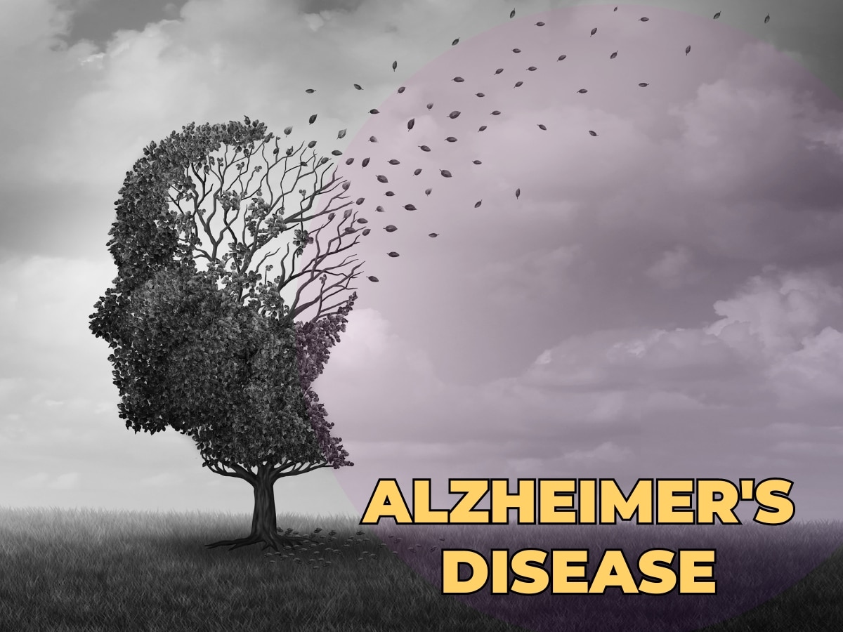 Alzheimer's Disease: अब अल्जाइमर का भी हो सकेगा इलाज, इस देश ने बीमारी की पहली दवा को दी मंजूरी