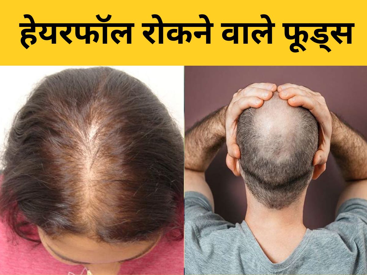 what-are-the-5-foods-which-can-help-to-stop-hair-fall-baldness-walnut