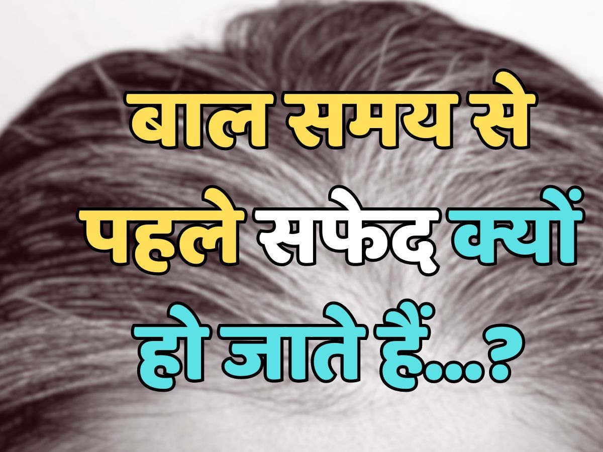 Trending Quiz : बाल समय से पहले सफेद क्यों हो जाते हैं?