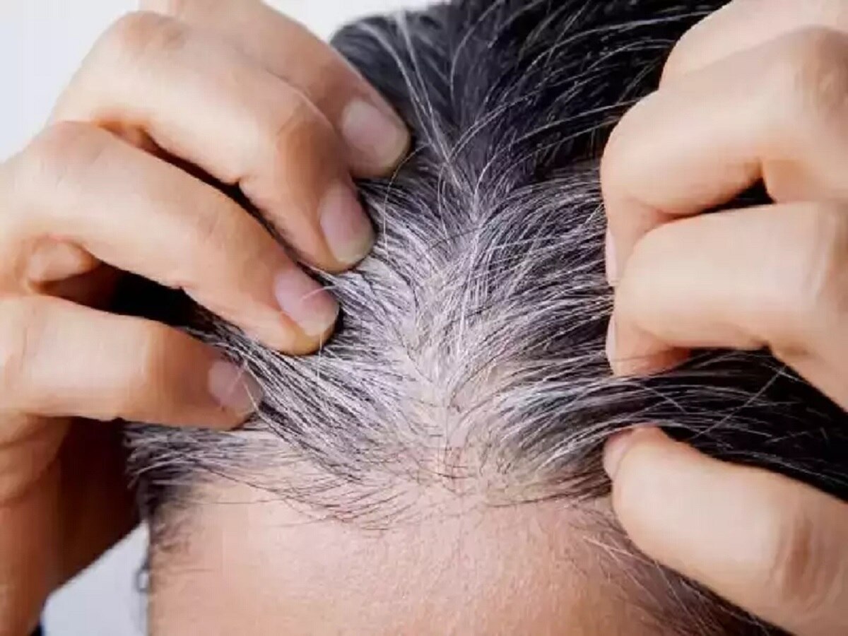 White Hair Home Remedy: आयुर्वेद के ये नुस्खे आपके बालों को रखेंगे काले, करें ये 4 उपाय 