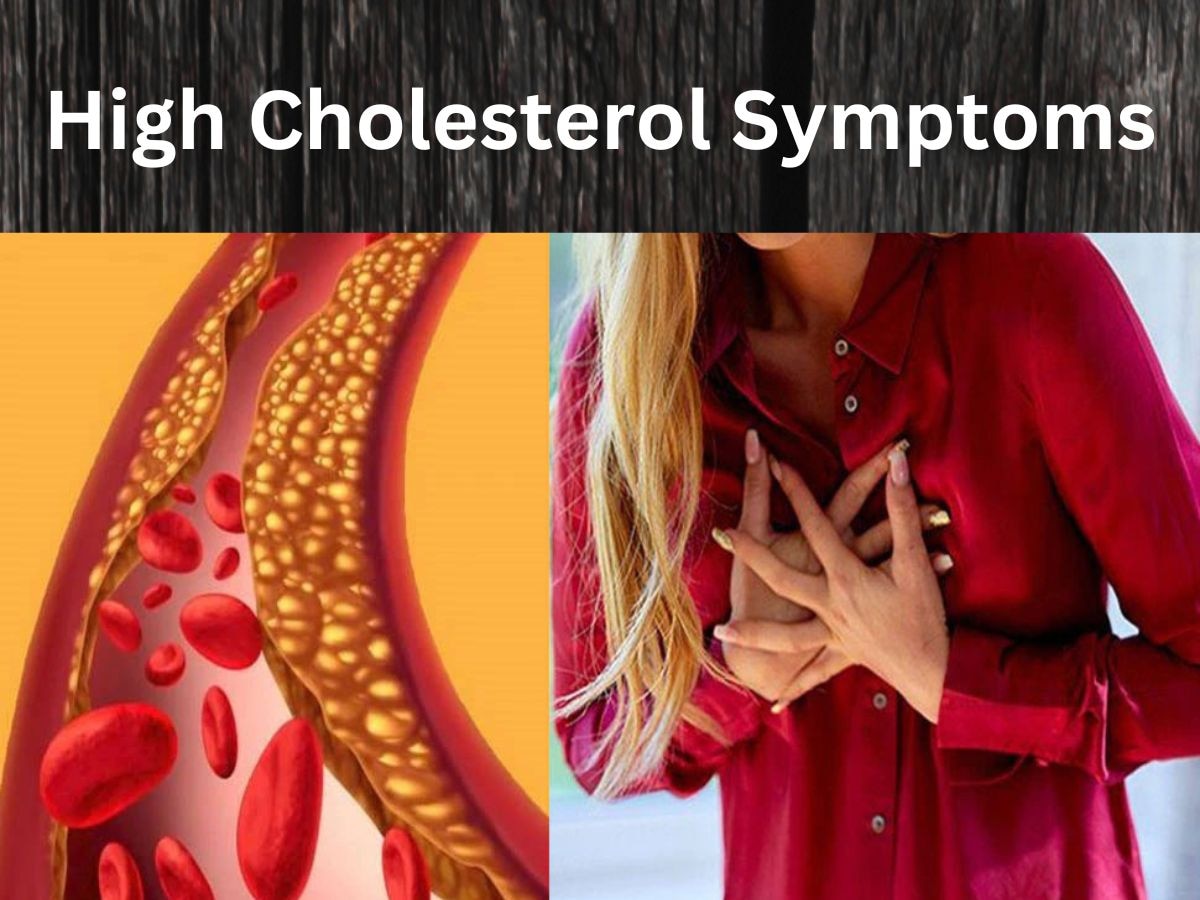 High Cholesterol: 25 से 30 की उम्र में कॉलेस्ट्रोल को लेकर न रहें बेफिक्र, इन लक्षणों को इग्नोर करना पड़ेगा भारी