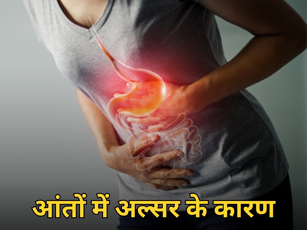 Peptic ulcer: आंतों में अल्सर का कारण बनती हैं आपकी ये आदतें, जानिए घर में कैसे करें इलाज?