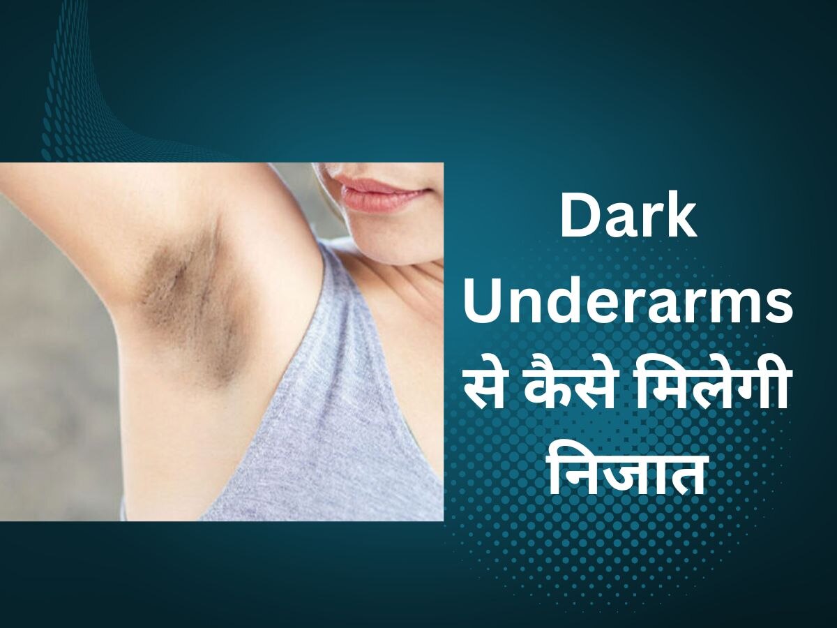 Dark Underarms: शर्मिंदगी की वजह बन गए डार्क अंडरआर्म्स, इस तरह दूर होगा बगल का कालापन