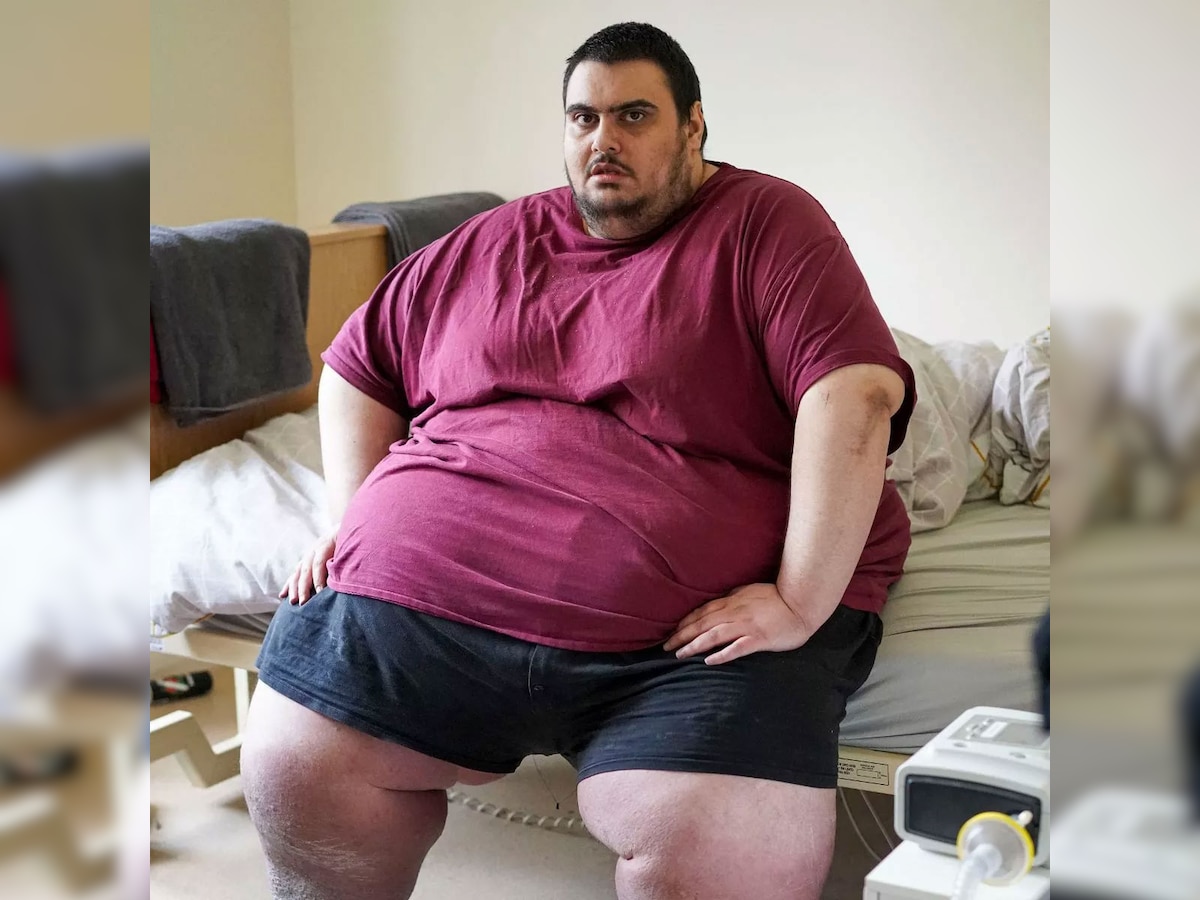 NO WEIGH Who is Jason Holton Heaviest man of UK refer to Zoo for X Ray ...