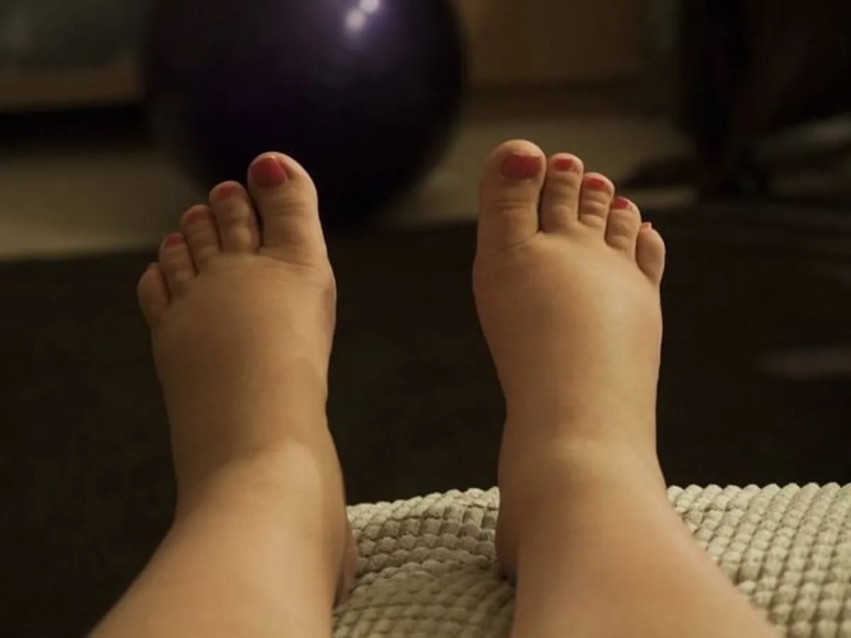 Swelling Feet Home Remedies: पैरों की सूजन को मिनटों में दूर करेंगे ये उपाय, जानें कैसे!