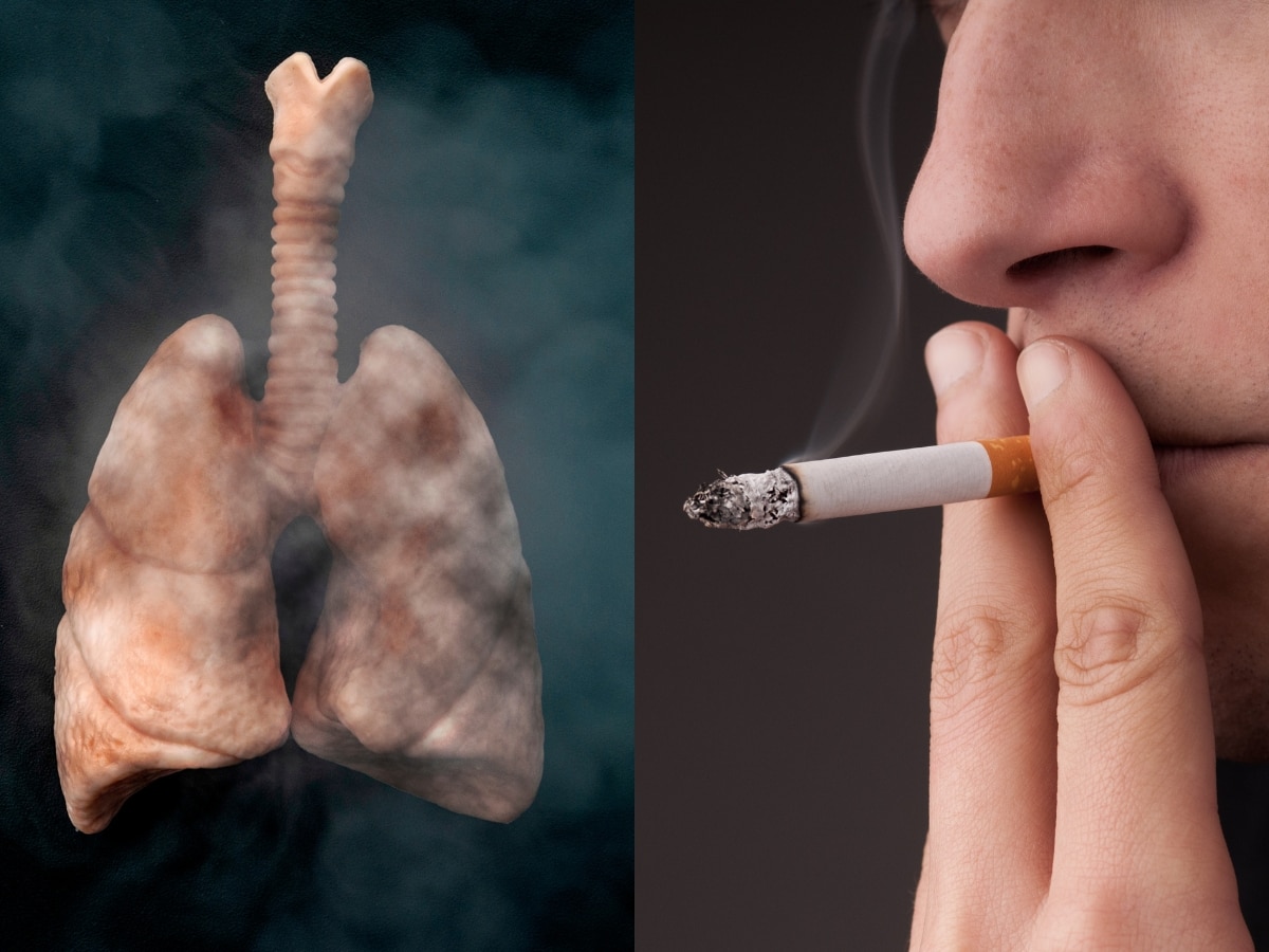 धूम्रपान करने वालों को ही होता है फेफड़ों का कैंसर? Cancer से जुड़े इन 5 Myths को न समझें सच