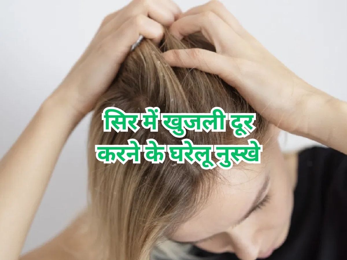 Hair Care Tips: सिर में हो जाए इंफेक्शन या सताए खुजली? अपना लें ये 3 घरेलू नुस्खे, फट से मिल जाएगा आराम