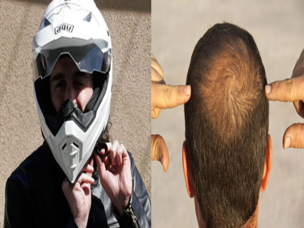 Helmet is making people bald does it cause hair loss । Helmet बना रहा