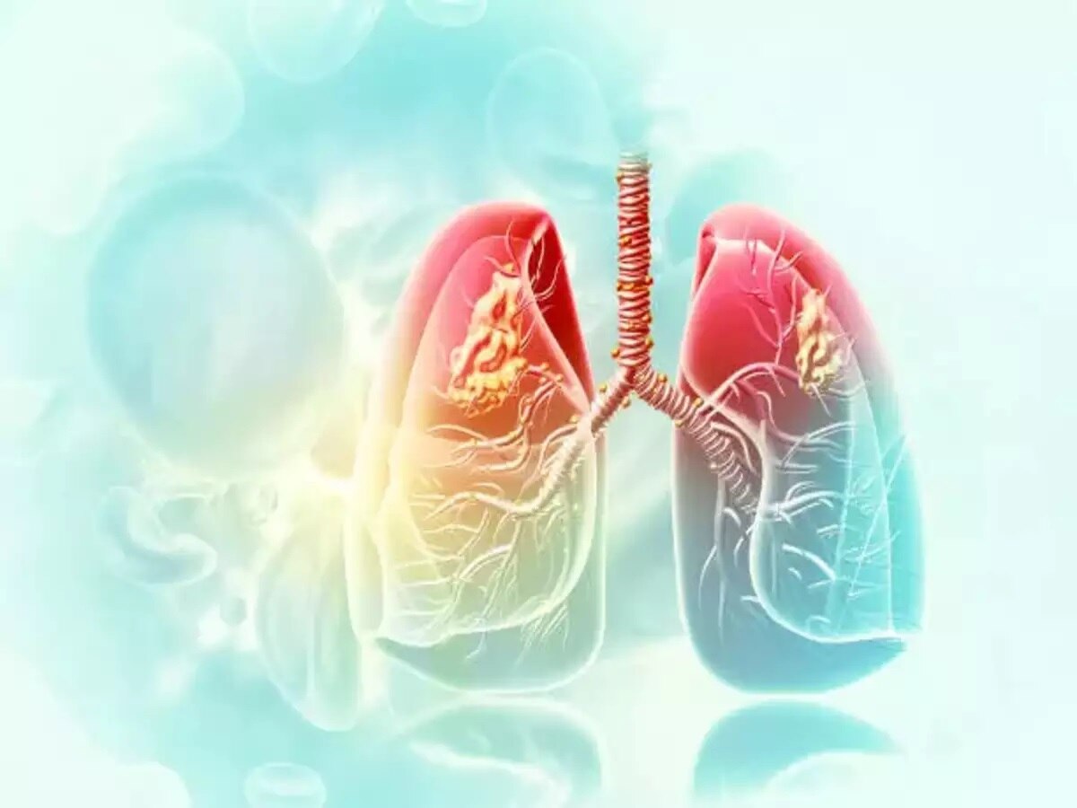 National Healthy Lung Month: आपके फेफड़ों के स्वास्थ्य के लिए ये है महत्वपूर्ण टिप्स, जानें 