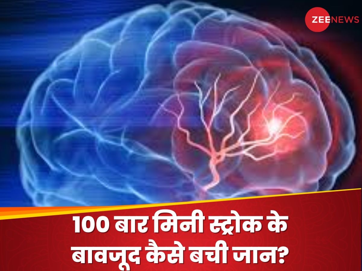 Mini Stroke: 1 हफ्ते में 100 बार मिनी स्ट्रोक, फिर कैसे बची जान? कहीं आप भी तो नहीं कर रहे ये गलती