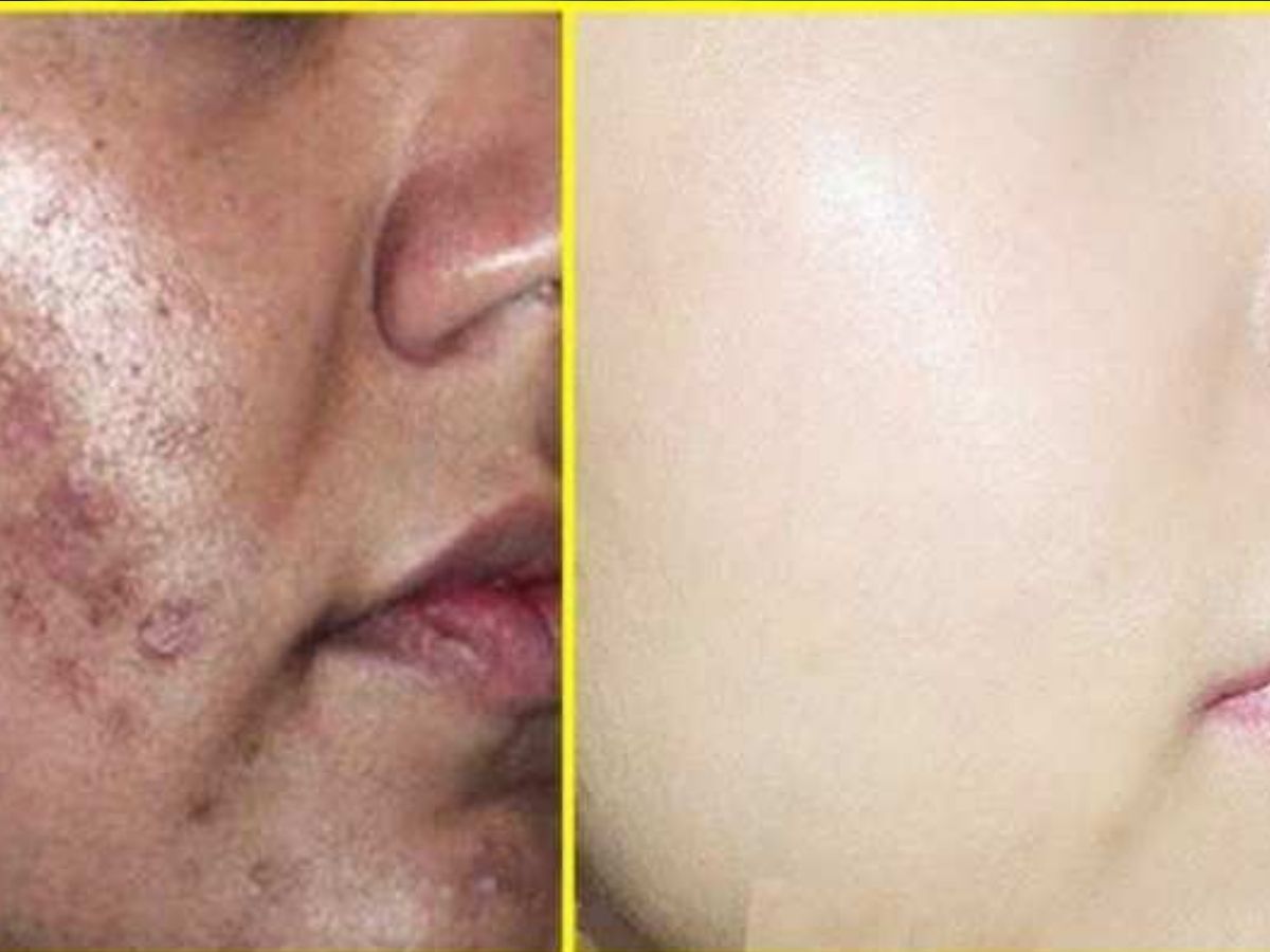 Health Benefits of Giloy: बदल रहे इस मौसम में पीना शुरू कर दें गिलोय का जूस, रोगों को जड़ से कर देता है साफ 12 फिट रहेगी स्किन