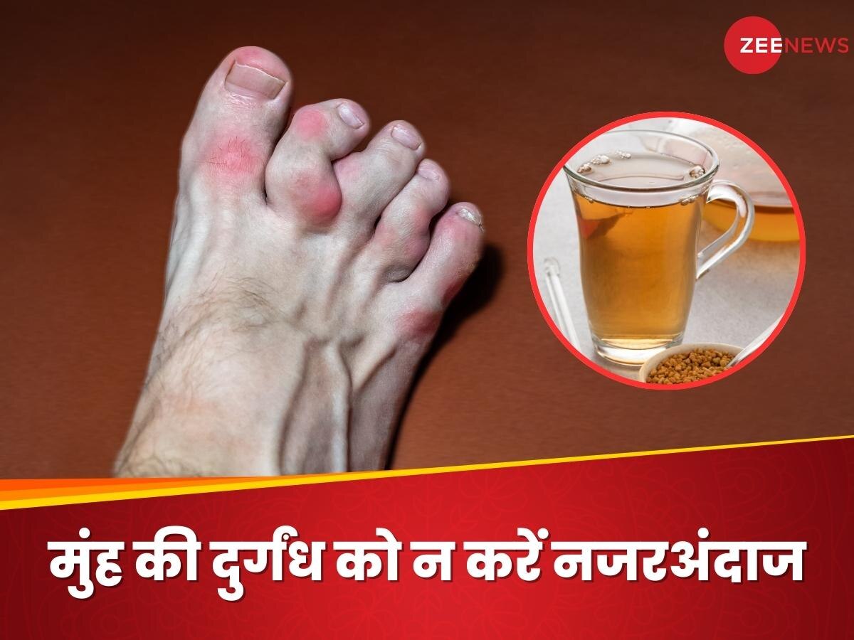 Uric Acid: खून से यूरिक एसिड को अलग कर देगा ये चमत्कारी पानी, खाली पेट पीने से मिलेंगे गजब के फायदे