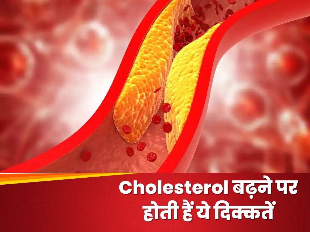 Cholesterol बढ़ने पर होती हैं ये दिक्कतें, भूलकर भी न करें नजरअंदाज 