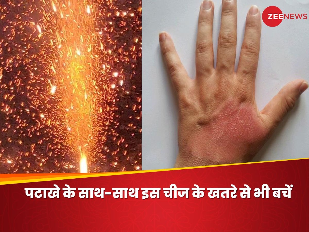 Diwali पर पटाखों से नहीं, इस चीज से लगती है ज्यादा आग, AIIMS ने किया चौंकाने वाला खुलासा