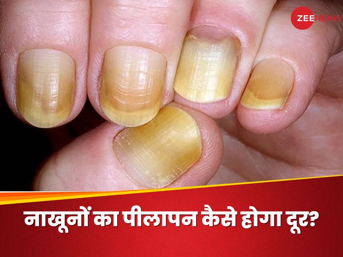 How To Clean Dirty Yellow Nails Easy Hacks Peele Nakhun Kaise Saaf