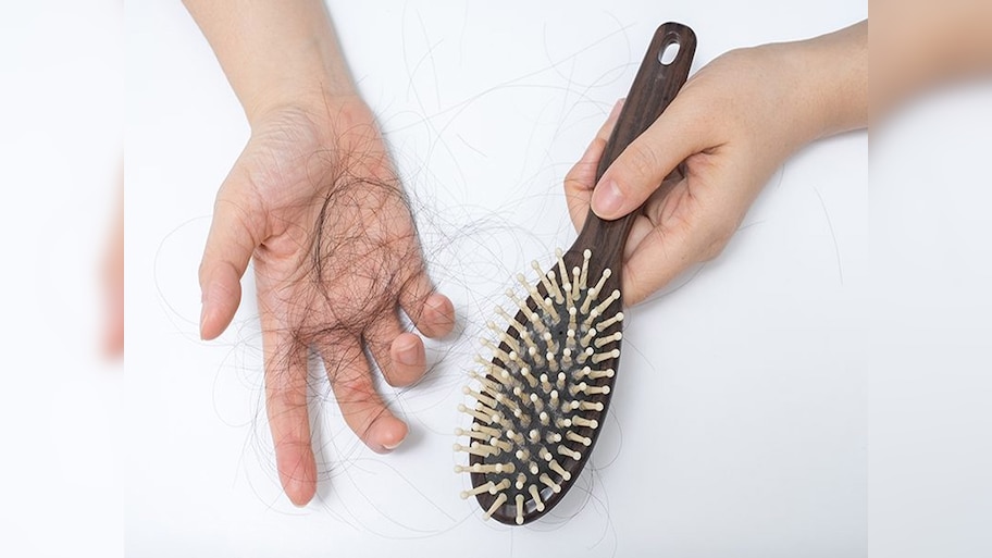 Stop Hairfall: क्यों झड़ते हैं बाल और कैसे करें इलाज? जानें पूरी डिटेल