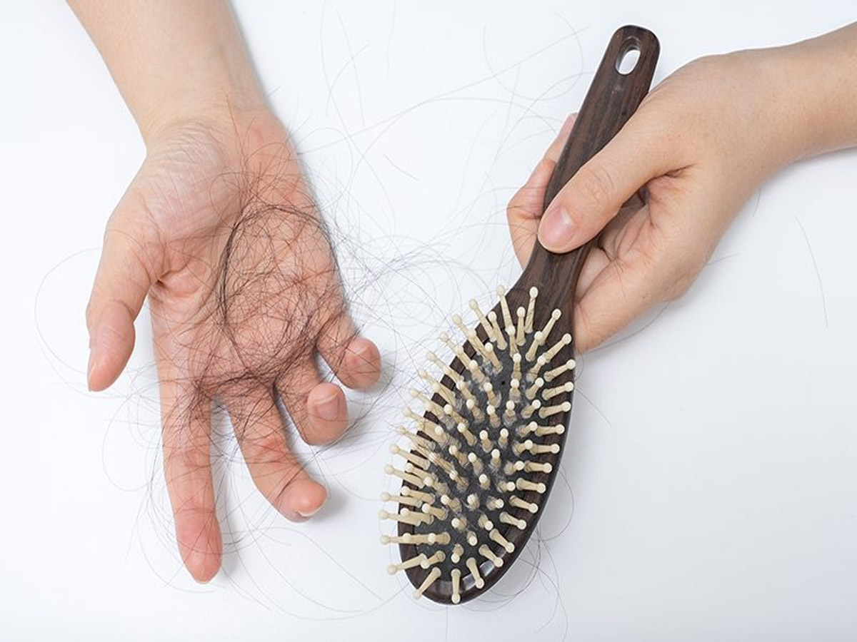Stop Hairfall: क्यों झड़ते हैं बाल और कैसे करें इलाज? जानें पूरी डिटेल Stop Hairfall: क्यों झड़ते हैं बाल और कैसे करें इलाज? जानें पूरी डिटेल
