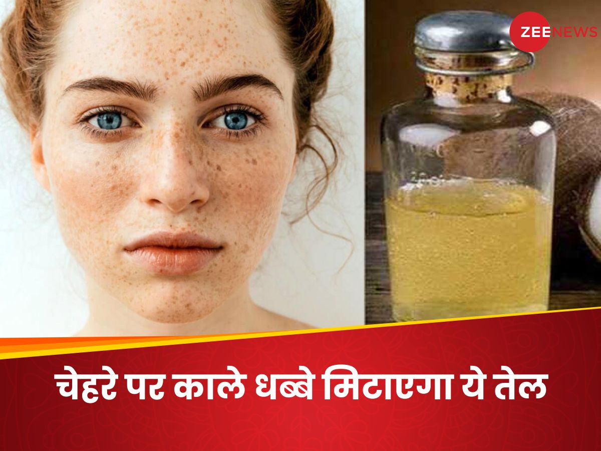 How To Get Rid Of Dark Spots From Face Using Coconut Oil nariyal tel