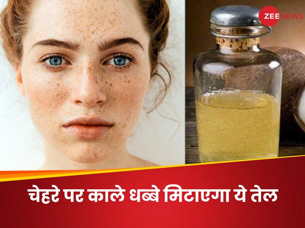 Skin Care: इस ऑयल की मदद से दूर होंगे फेस के डार्क स्पॉट्स, लेकिन संभलकर करना होगा इस्तेमाल