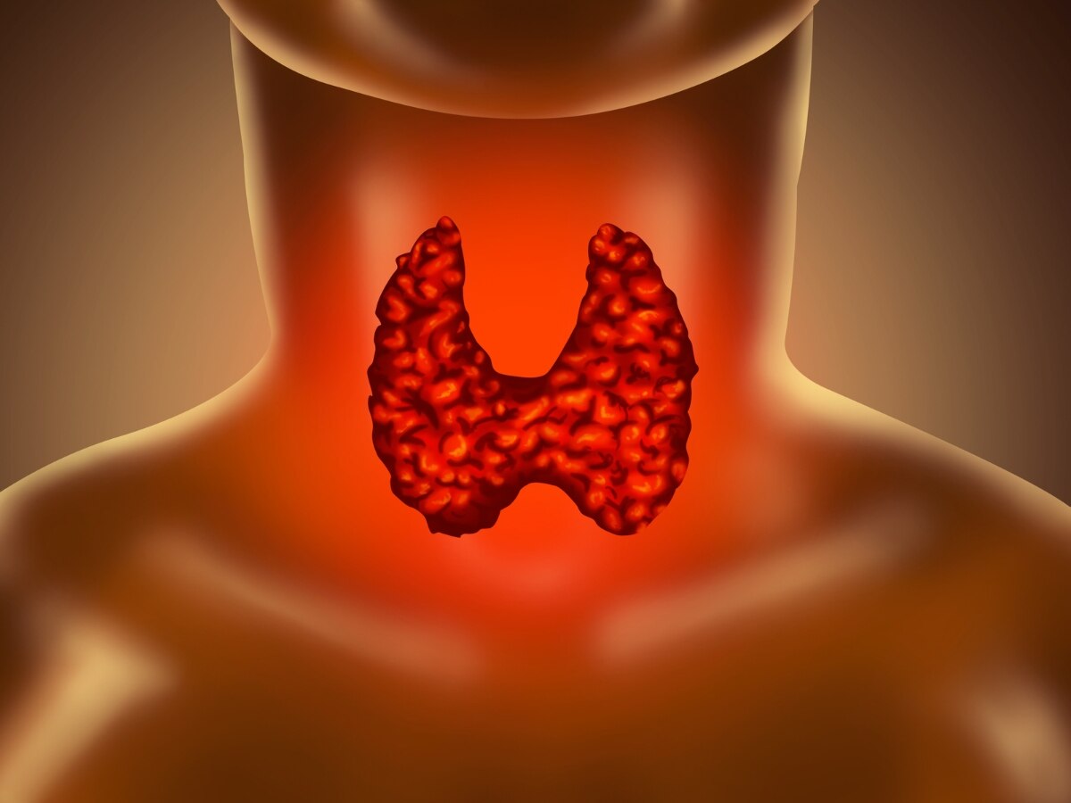 Thyroid Cancer: कहीं आपका थायरॉयड कैंसर में तो नहीं बन गया? इन संकेतों से करें पहचान