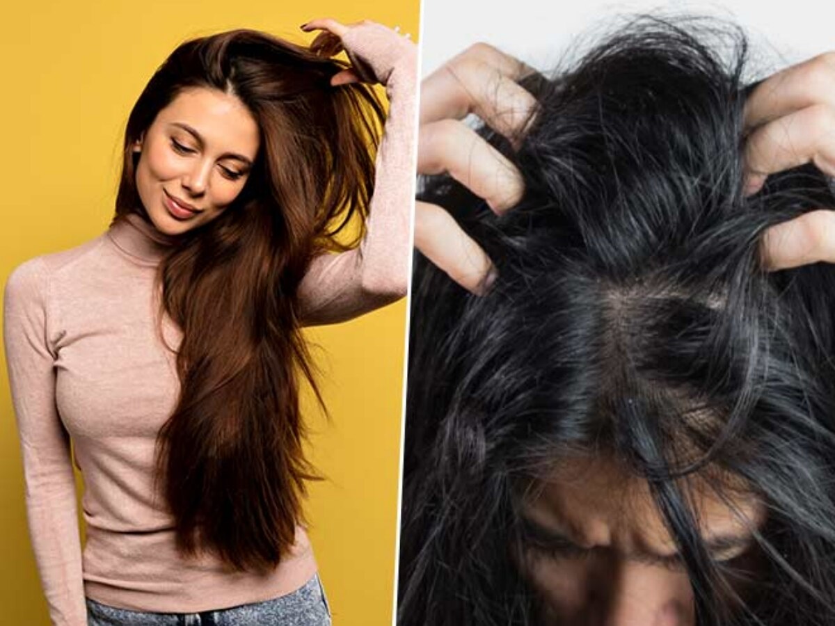 Oily Hair Remedies: धोने के तुरंत बाद क्यों ऑयली हो जाते हैं बाल, जानें समाधान