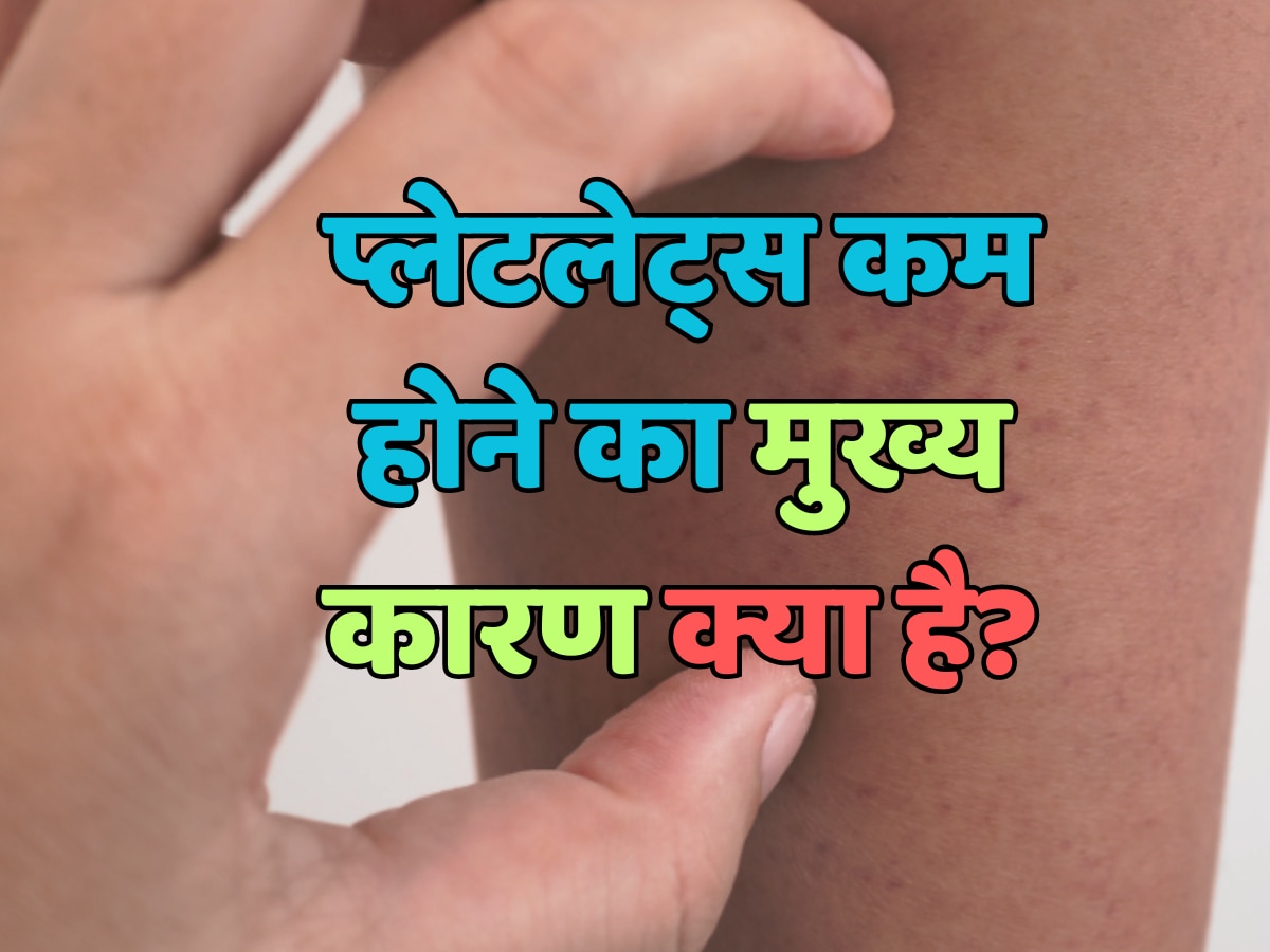 Trending Quiz : प्लेटलेट्स कम होने का मुख्य कारण क्या है?