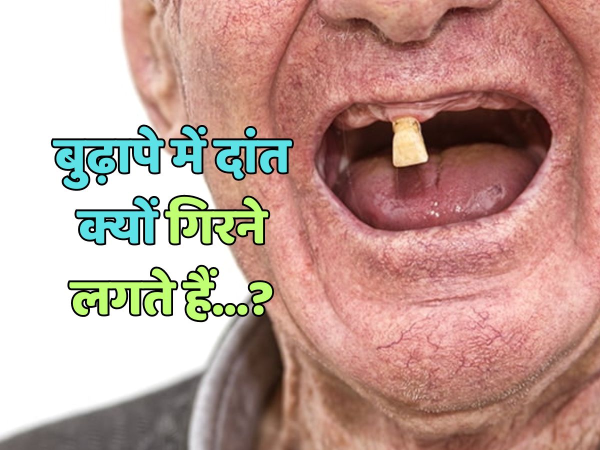 Trending Quiz : बुढ़ापे में दांत क्यों गिरने लगते हैं? Trending Quiz : बुढ़ापे में दांत क्यों गिरने लगते हैं?