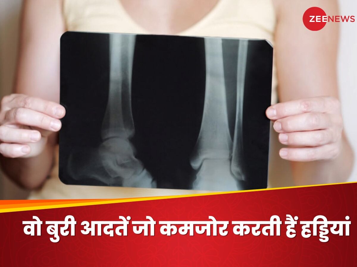 Bone Health: इन 5 बुरी आदतों से कमजोर होंगी हड्डियां, आज ही कर लें पूरी तरह तौबा