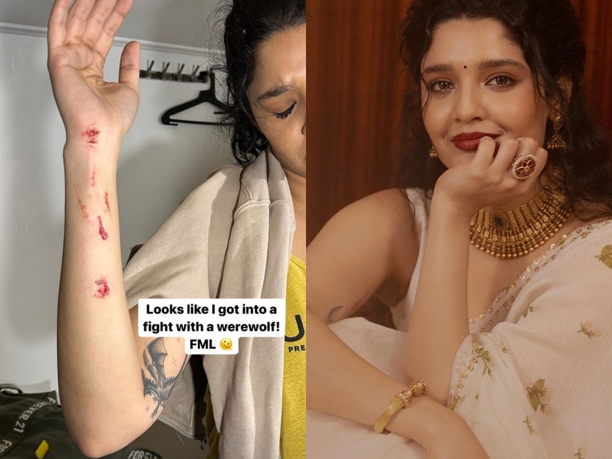 South Actress Ritika Singh: साउथ की फेमस एक्ट्रेस रितिका सिंह हुईं घायल, सोशल मीडिया पर बताई चोट लगने की वजह 