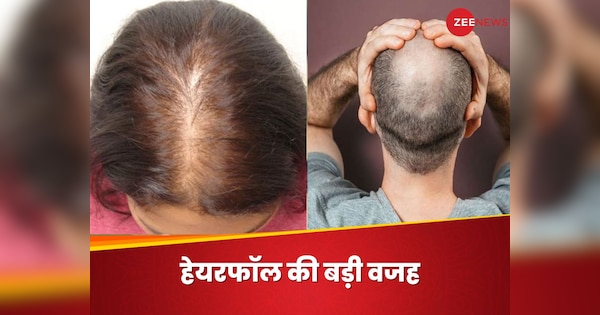 Which Deficiency Leads To Hair Fall