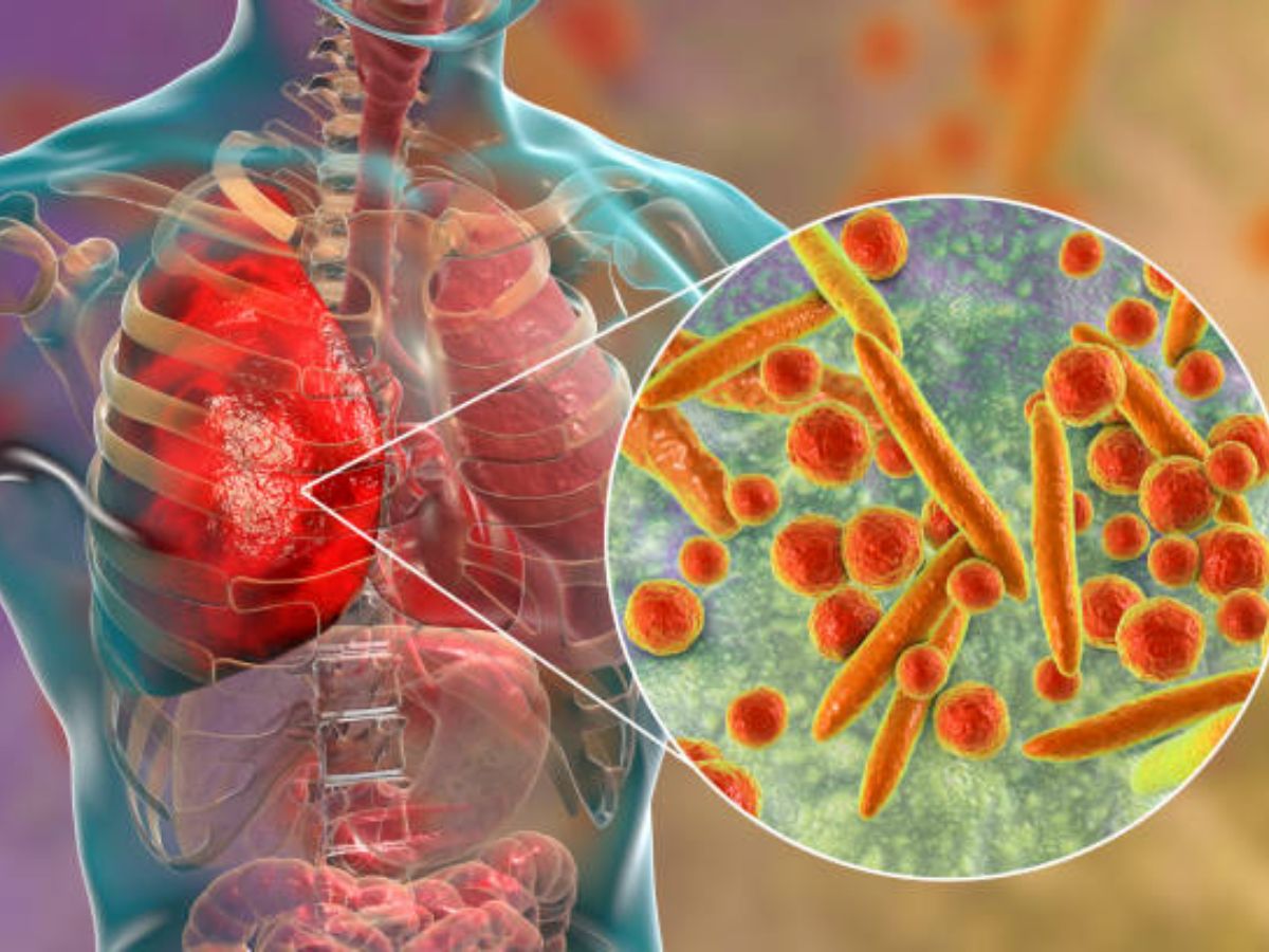 Mycoplasma Pneumoniae: चीन में कहर बरपा रहा नया वायरस कितना खतरनाक, जानें कैसे करें बचाव और क्या हैं लक्षण?