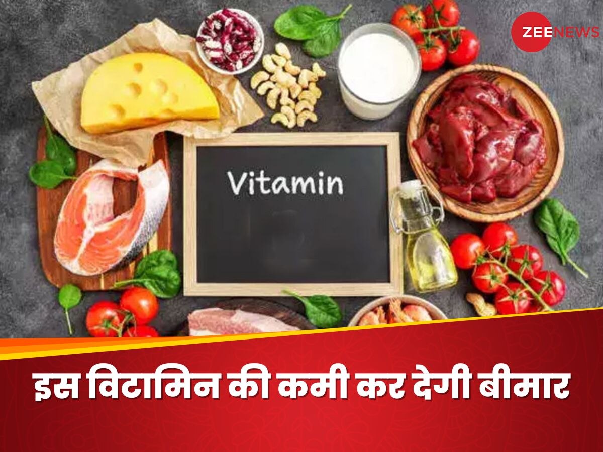 Vitamin Deficiency: शरीर में भूल से भी न होने दें इस विटामिन की कमी, वरना कई फायदों से रह जाएंगे महरूम