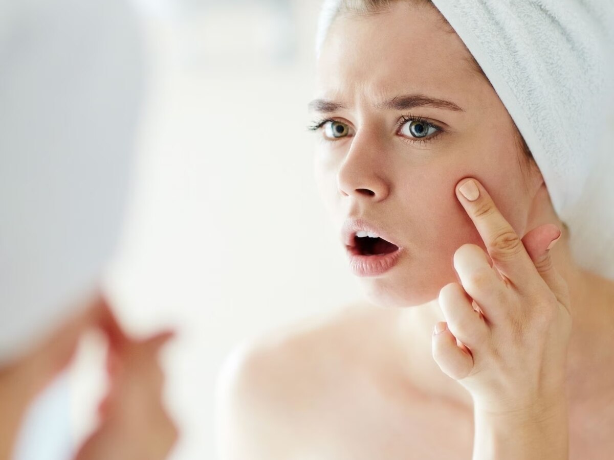 त्वचा बेजान 