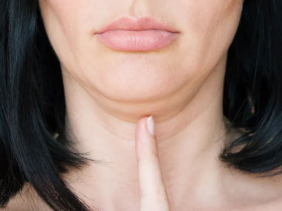 डबल चिन हटाने की एक्सरसाइज