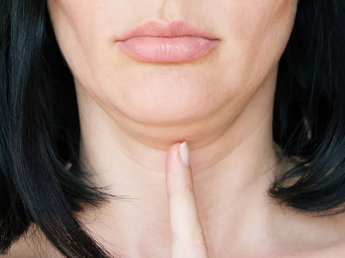 डबल चिन हटाने की एक्सरसाइज