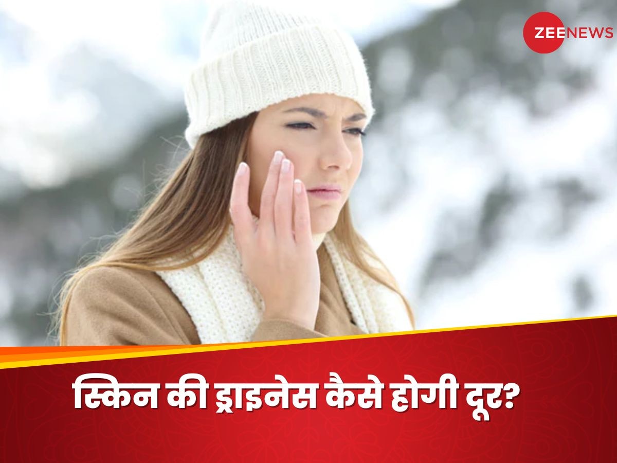 Skin Dryness: सर्दियों में स्किन की ड्राइनेस कैसे करें दूर? ये 5 ट्रिक्स आएगी काम