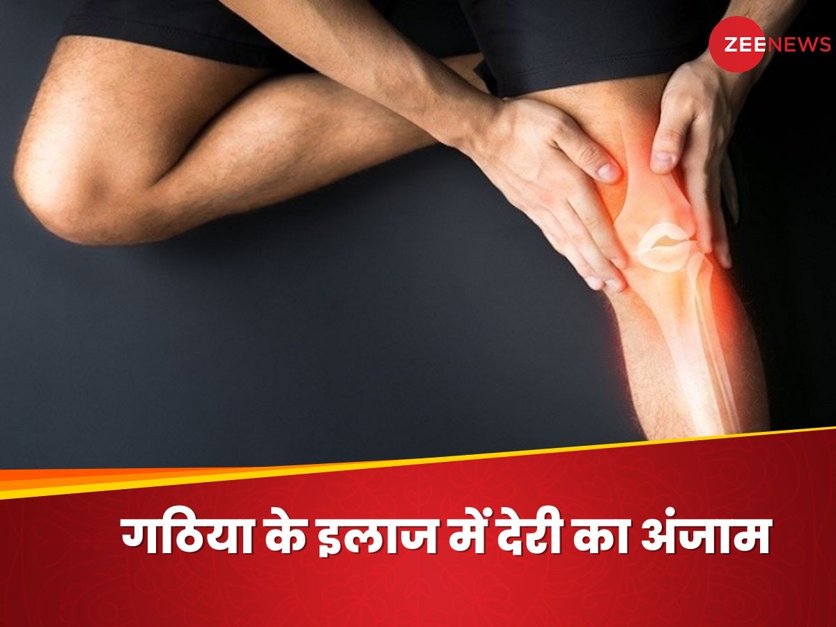 Arthritis के इलाज में आनाकानी पड़ सकती है भारी, कहीं ये वाली हड्डी न हो जाए डैमेज!