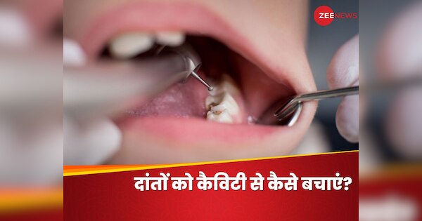 danto-ki-sadan-ka-ilaj-how-to-get-rid-of-teeth-cavity-oral-health-tooth