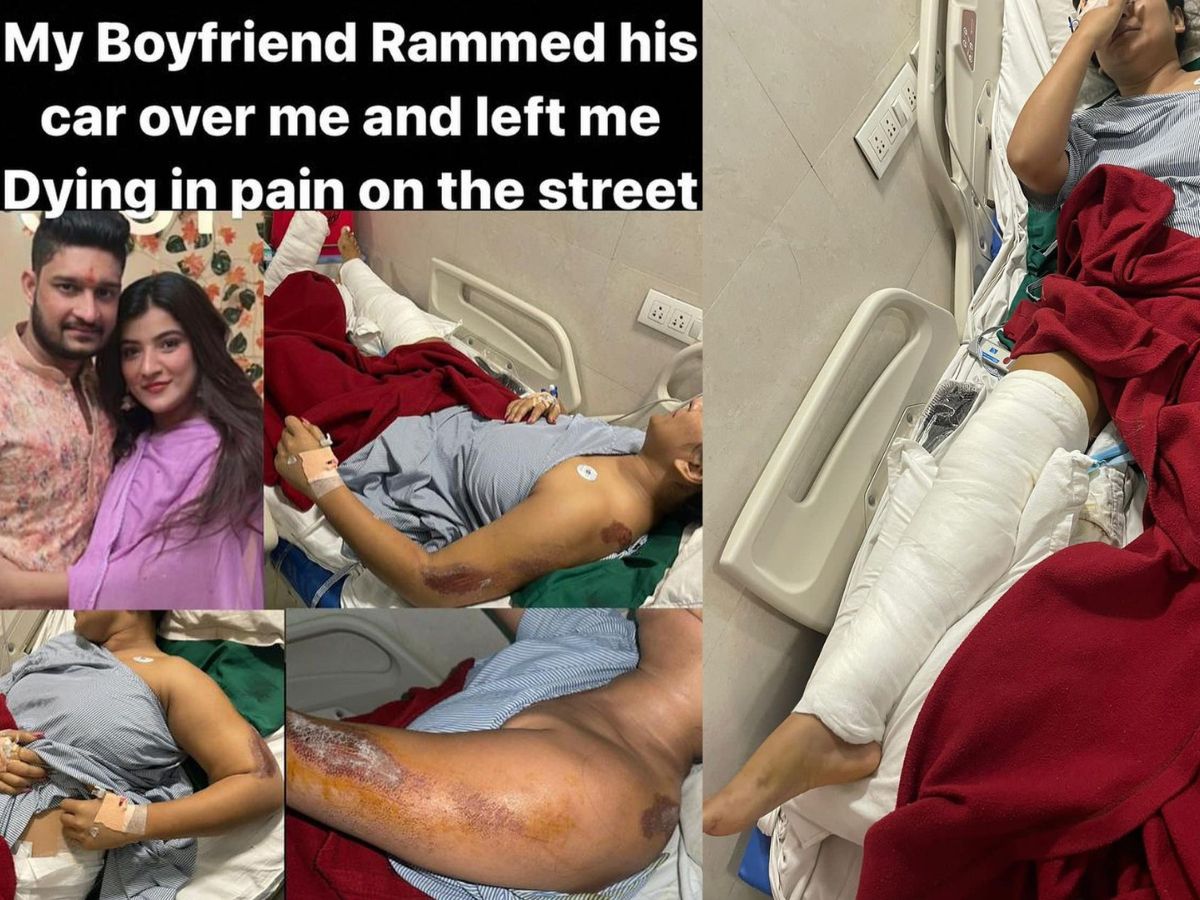 IAS के बेटे की घिनौनी करतूत, दोस्तों के संग मिलकर गर्लफ्रेंड को बेहरमी से पीटा, फिर गाड़ी से पैर कुचला 