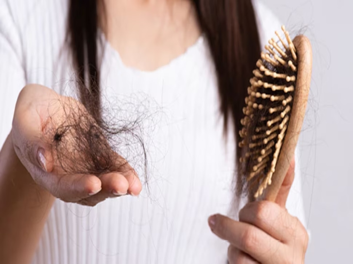 Hair Fall Tips: ठंड में बाल झड़ने के पीछे का क्या है साइंस, इन घरेलू नुस्खों से करें बचाव