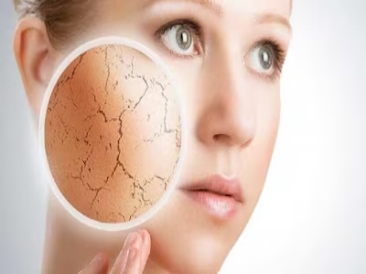 Dry Skin tips: ठंड में क्यों होता है त्वचा का रूखापन? जानें इसके पीछे क्या है साइंस?