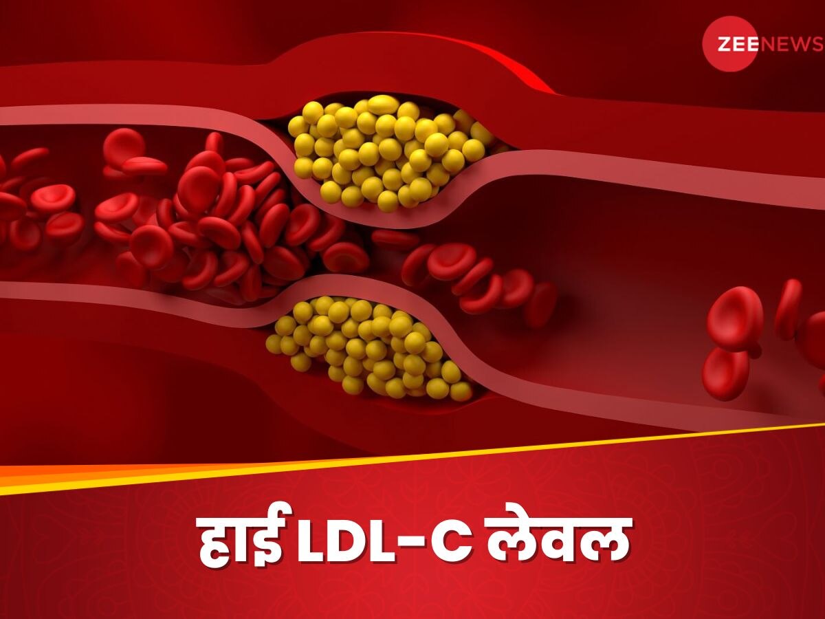 दिल के लिए बेहद खतरनाक है हाई LDL-C लेवल, जानिए किन कारणों की वजह से बढ़ता है स्तर?
