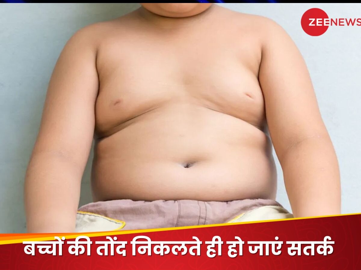 Obesity in Children: मोटा मतलब बीमार, मेडिकल साइंस की नई परिभाषा में बीमारी कहलाएगी मोटापा