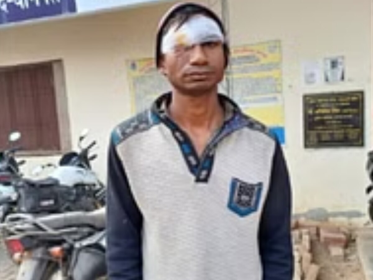 Baghpat News: मोबाइल चलाने से मना कर रहे पति की आई शामत, झल्लाई पत्नी ने आंख में घोंप दी कैंची