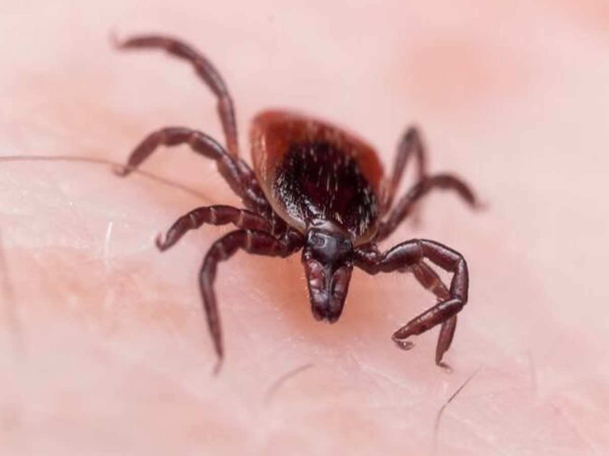 Lyme Disease: हिमाचल प्रदेश में इस नई बीमारी ने दी दस्तक, जानें क्या हैं इसके लक्षण