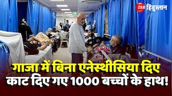UN का बड़ा दावा, गाजा में बिना एनेस्थीसिया दिए ही काट दिए गए 1000 बच्चों के हाथ!