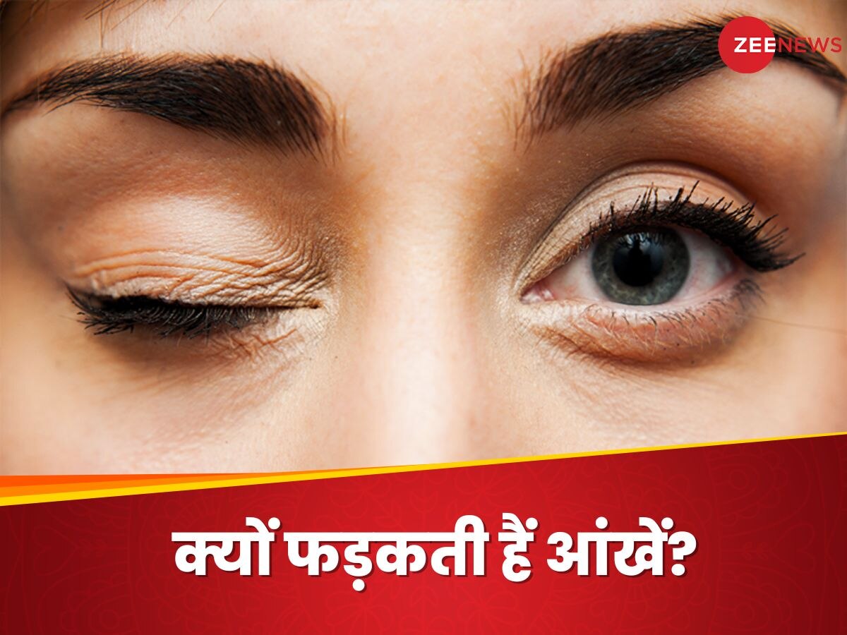 Eye Twitching: किस विटामिन की कमी से फड़कती हैं आंखें? जानें इसके पीछे का साइंस